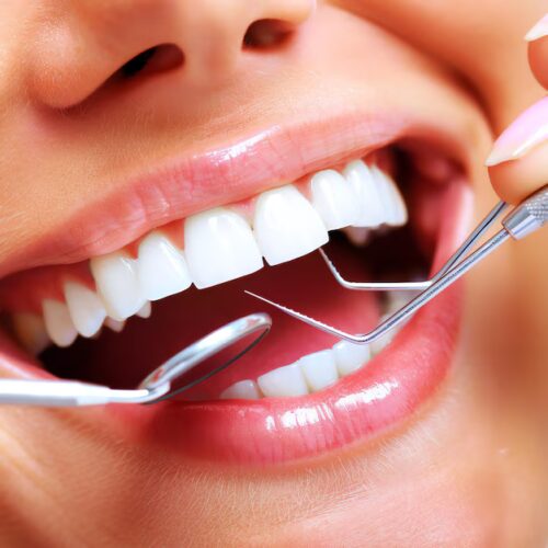 patient-having-dental-treatment-with-tool-patients-mouth-dentistry-improved-smile_326694-270509